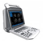 Ultrasound – Portable Digital Black and White Scanner